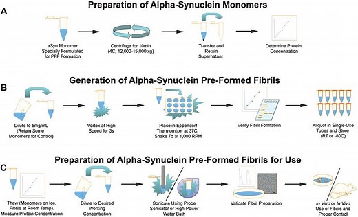 Differentiating PD from MSA