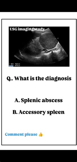 What is the diagnosis #ultrasound | Usg Imaging Study