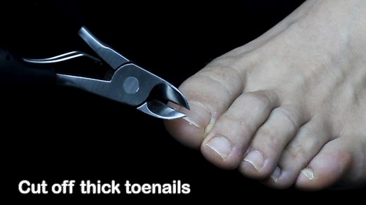 Watch HOW to Use DR. MODE 8PCS Toenail Clippers? on Amazon Live