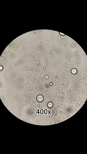 Microscope Under on Instagram: "Under The Microscope➡️Pork Liver . . . . . . #Microscope #microscope_world #pork #porkliver #microscopechallenge.#instagram #instsgramreels #viralreels #amazing #tranding #trandingreels"