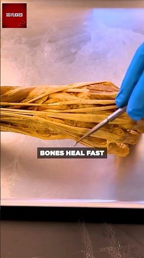 Why Wolverine's Claws Would Destroy His Arms Forever 💀