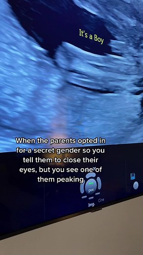 Here at WTTW we offer a secret gender reveal option for those who don’t want to find out baby’s gender in the room❤️ We do see the peakers👀 🤣#babyscan #wttw #genderscan #4dscan
