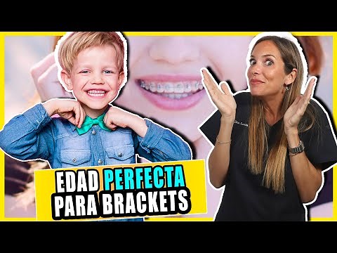👉¿A que EDAD se COLOCAN los BRACKETS? - Descubre Para que sirve LA ORTODONCIA (Te sorprenderá 😲)