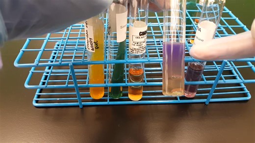 Biochemical testing ❤️♥️❤️ #lablife #microbiology #diagnosis #parasitology | Lab life