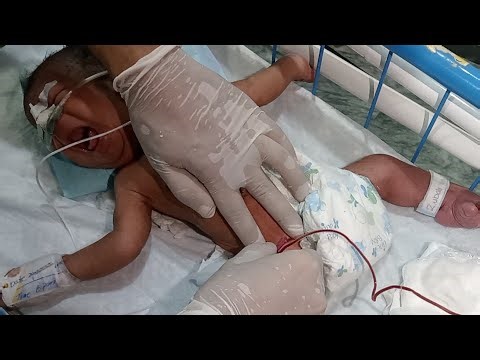 ABG Test Full Guide | Arterial Blood Gas Sampling & Interpretation