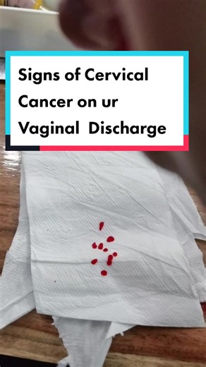 Signs of Cervical Cancer: Understanding Vaginal Discharge