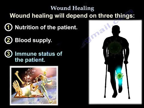 Wound Healing , nutrition - Everything You Need To Know - Dr. Nabil Ebraheim