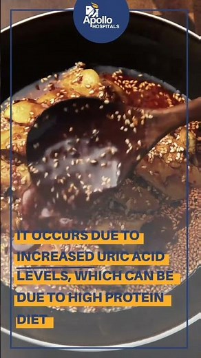 Did you Know, Gout is the most painful joint pain? | Apollo Hospitals