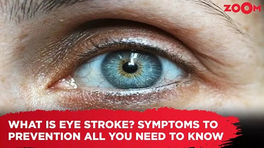 What is an eye stroke? Symptoms to prevention, all you need to know