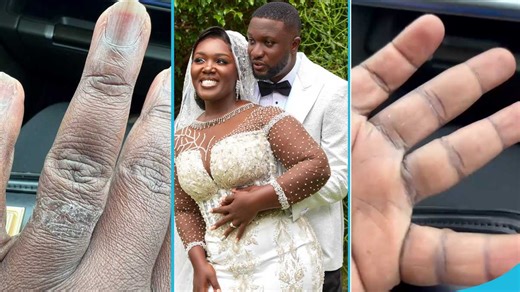 Tima shuts down divorce rumours, explains in video how ring damaged her finger