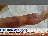 Thermomix blenders explode leaving people with third-degree burns