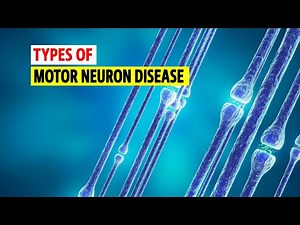 Types of Motor neuron disease