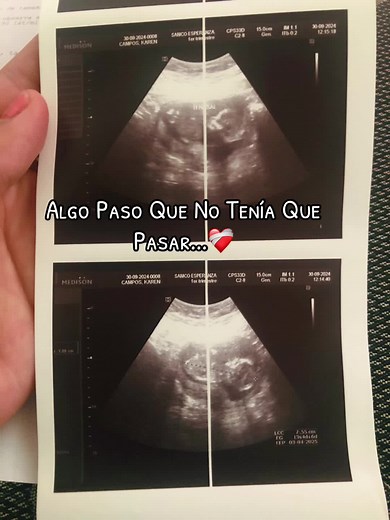 Experiencing Early Motherhood Through Ultrasound Images