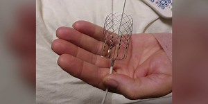 Medical Moment: The new experimental device treating heart failure