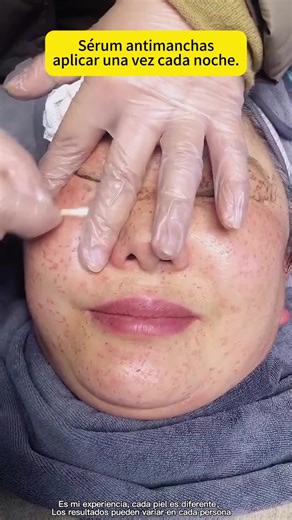 🌞 ¿Usas protector solar pero las manchas siguen? El protector protege, no borra. Esto sí borra. PAPAFEEL Sérum 577: el complemento perfecto para tu fotoprotección. 🤝 Protector solar para prevenir. 577 para corregir. El equipo perfecto contra las manchas. Juntos son imparables. ¡Prevención y corrección! 🛡️⚔️ #papafeel #papafeelmx #Manchas #Sérum577 #VentaQuincenal keyword：PAPAFEEL Sérum 577, sérum antimanchas 577, sérum facial blanqueador, 4-en-1 blanqueador, 577 niacinamida VC α-arbutina, ret