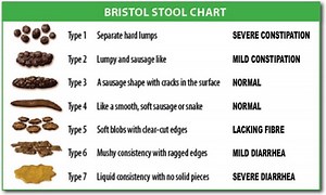 Bristol stool scale - Alchetron, The Free Social Encyclopedia
