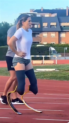 This Girl Won The Race Even Without Legs #reels #reaction #fyp #omg #shocking | viral Hub
