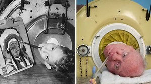The Man Who Lived 70 Years in an Iron Lung