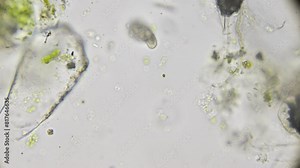 Under the microscope, a drop of pond water reveals a dense population of microorganisms, including the swift movements of paramecia and spirulina.