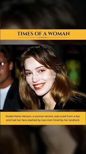 Model Marla Hanson, a woman tenant, was lured from a bar and had her face slashed by two Men.