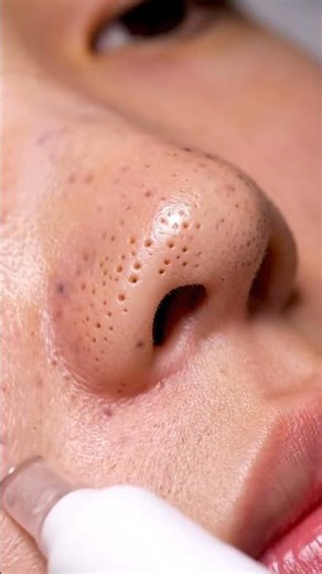 “Precision Vacuum ASMR 💨 | Gentle Air Pull & Whisper Relaxation”