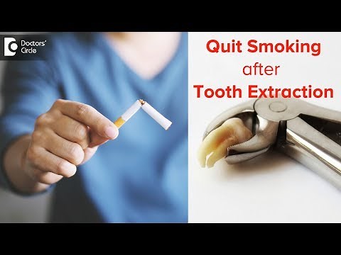 Do I need to quit smoking after tooth extraction? | Prevent Dry Socket - Dr. Rizwana Tarannum