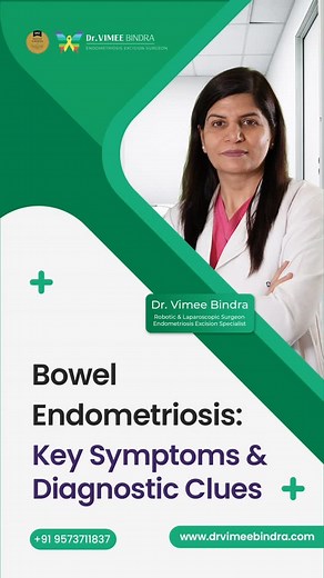 111 reactions · 35 shares | Bowel endometriosis happens when...
