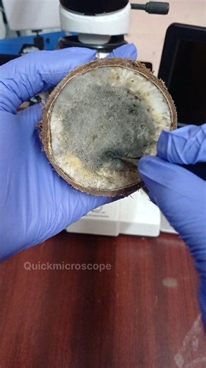 "fungus Under The Microscope: Rhizopus!" Explained in 140 Seconds Discover the fascinating world of fungus under the microscope! See Rhizopus in detail in just 140 seconds. Watch & learn now!👍 #fungus #undermicroscope #science #education #rhizopus #botany #poonjai #Fungustreatment #fungi #Quickmicroscope | Quickmicroscope