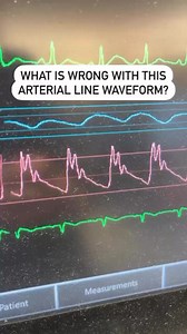 6.4K views · 17 reactions | Can you tell what is wrong with this...