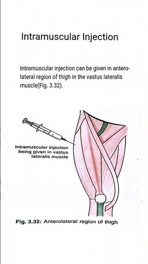 Intramuscular Injection in the Vastus Lateralis Muscle