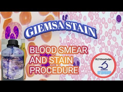 BLOOD SMEAR & GIEMSA STAIN PROCEDURE