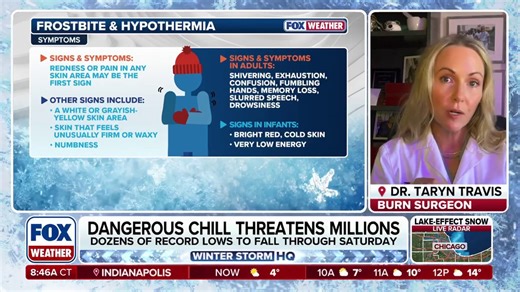 Doctor details dangers of frostbite as extreme cold threatens millions