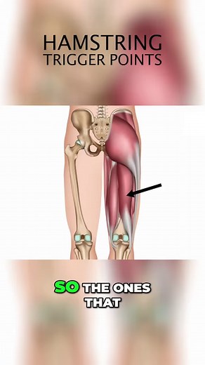 3.4K views · 43 reactions | Discover how trigger points in the hamstring muscles can lead to persistent buttock pain in this quick overview. Learn about common symptoms, causes, and effective treatments to alleviate discomfort. Perfect for massage therapists and fitness professionals looking to expand their knowledge on muscle health and pain relief. Don’t miss this essential insight into managing and preventing pain! | NAT Global Campus | Facebook