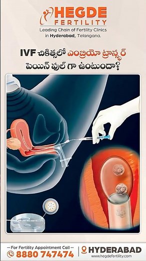 Embryo Transfer in IVF | Is It Painful? | Fresh vs Frozen | Embryo Transfer Process | #IVF #IUI