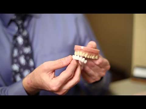 How to Whiten Yellowed False Teeth : Dental Hygiene