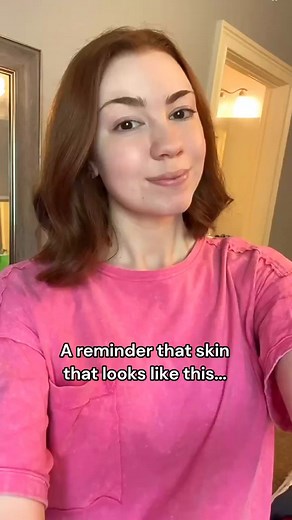 8.2K views · 41 reactions | What’s one thing you’ve learned to love about your skin?  Today is National Love Your Skin Day! Here is your reminder that real skin has texture, changes with the light, and is beautiful in every form. Let’s celebrate it all, no filters needed!✨️ | Plexus Worldwide | Facebook