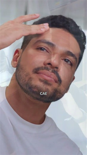 Pérdida de cabello masculina | Resultados reales en 20 días