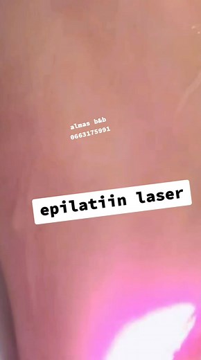1.2K views | Epilation laser....