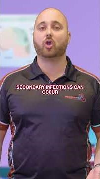 Can a White Tail Spider kill a human? #shorts