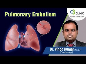 நுரையீரல் தக்கையடைப்பு என்றால் என்ன? | Pulmonary Thromboembolism Explained In Tamil |Dr. Vinod Kumar