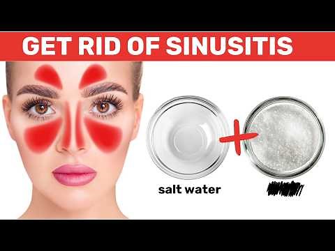 How to Cure Sinus Problems with a Simple Fix | #1 Remedy for Sinusitis and Sinus Infections