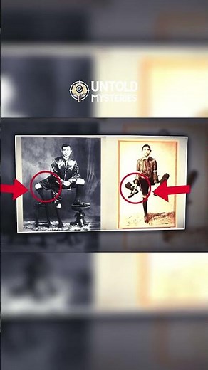 Frank Lentini: The Three-Legged Circus Sensation & Inspiring Legend | Untold Mysteries 🎪✨