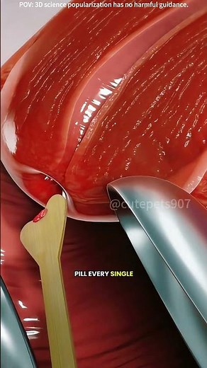 How iuds works intrauterine device(3D animation) #drone #doctor #3danimation #theflash #keyhole