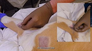 Elbow Injection (Medial Approach) Demonstration