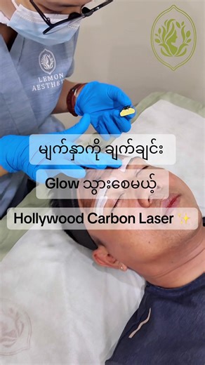 မျက်နှာကို ချက်ချင်း Glow သွားစေမယ့် Hollywood Carbon Laser ✨🥰#arrow #lemonaesthetic #fypage #HollywoodcarbonLaser#fyp