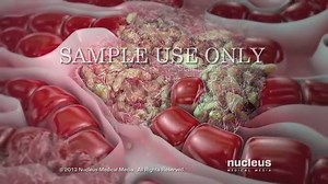 Hepatitis C | Davidson's Principles and Practice of Medicine