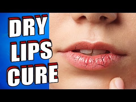 DRY LIPS Fast Cure: Best Natural Treatment for DRY LIPS using a LIP BALM