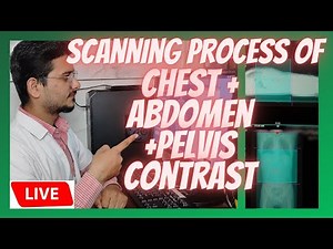 live CT Scan of Chest+ Abdomen and Pelvis Contrast | scanning process of CECT chest+ abdomen pelvis