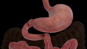 Laparoscopic Roux-en-y Gastric Bypass