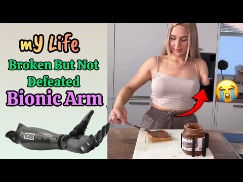 mY LIFE - With Bionic Arm 💔🙃 | Breastfeeding Pump Tutorial | Breast Pump